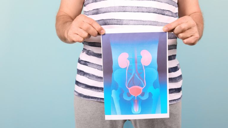 man holding a drawing of a prostate x ray over pelvis